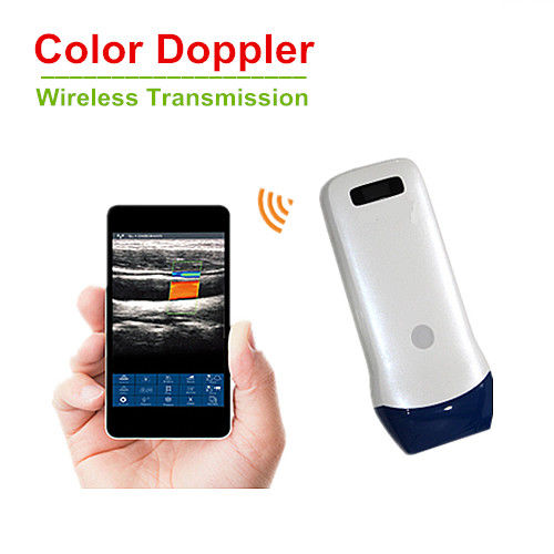 SonoStar Ασύρματος Διαγνωστικός Υπέρηχος Sonostar 7.5-10MHz Linear 128 Elements Color Doppler