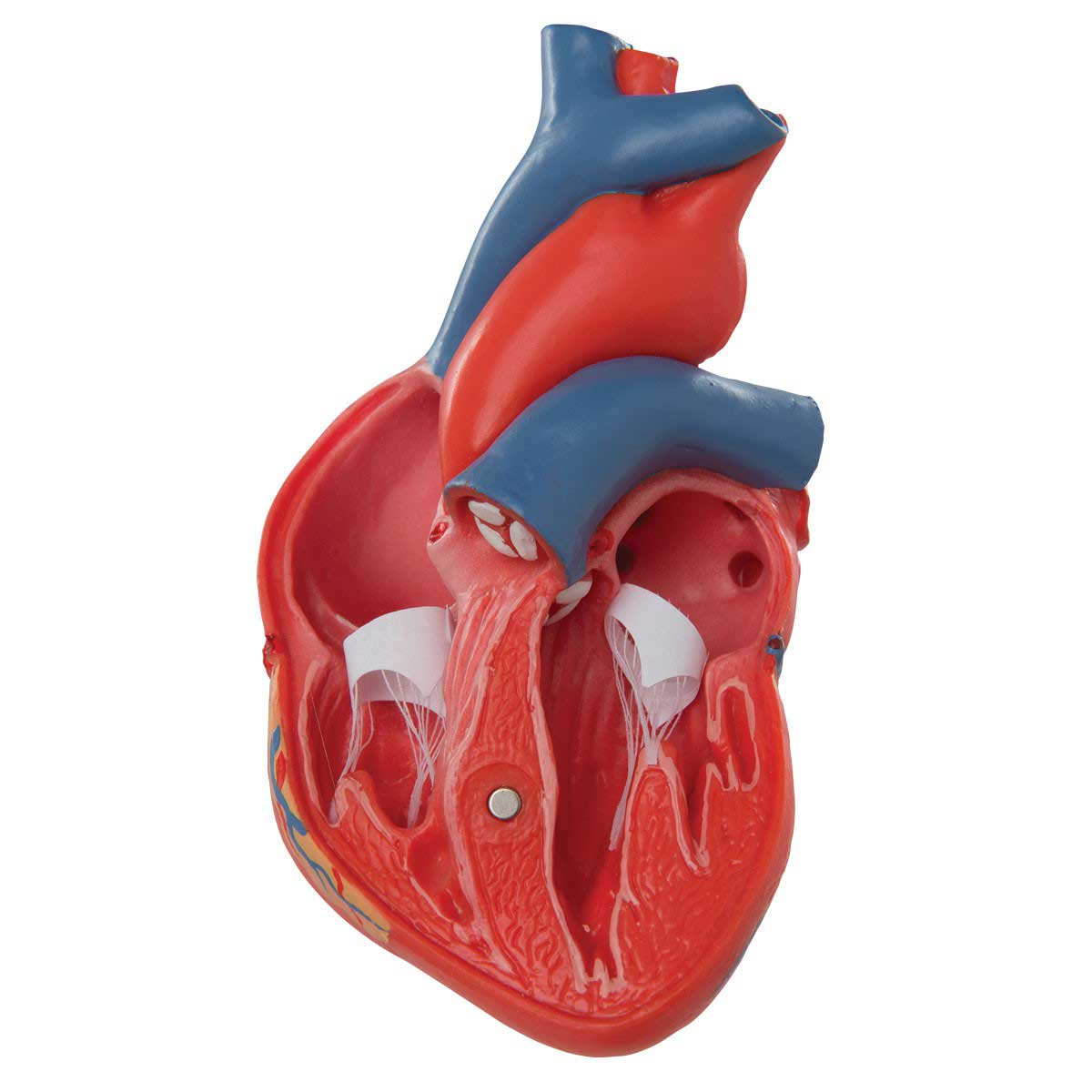 Изменения миокарда левого желудочка сердца. Миокард желудочка сердца. Миокард сердца анатомия. Сердечная мышца миокард. Левый желудочек сердца фото.