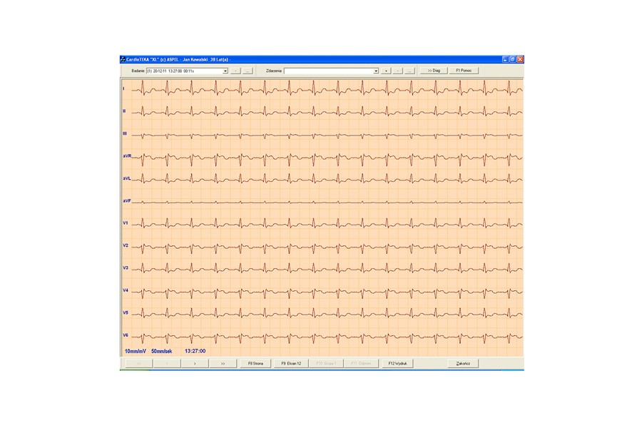 Aspel Λογισμικό Καρδιογράφων Aspel CardioTEKA