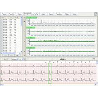 Holter Ρυθμού EDAN SE-2012