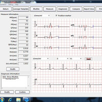 Λογισμικό EDAN Smart ECG-Viewer
