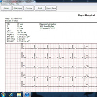 Λογισμικό EDAN Smart ECG-Viewer