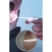 Φωτιζόμενες Κιουρέτες Αυτιών Bionix® Αρθρωτού Άκρου