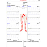 Doppler Αγγείων Sonicaid DMX με Κεφαλή 4MHz