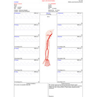 Doppler Αγγείων Sonicaid DMX με Κεφαλή 4MHz