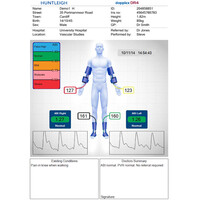 Doppler Αγγείων Sonicaid DMX με Κεφαλή 4MHz