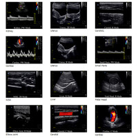 Φορητός Έγχρωμος Υπέρηχος Chison ECO5 με Doppler.