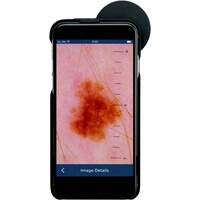 Δερματοσκόπιο HEINE® iC1 για iPhone 7/8