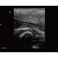 Ασπρόμαυρος Φορητός Υπέρηχος Chison ECO3 Expert με Doppler