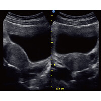 Ασπρόμαυρος Φορητός Υπέρηχος Chison ECO1 με 2 Θύρες