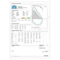 Σπιρόμετρο MIR Minispir με 60 Τουρμπίνες μ.χ FlowMir