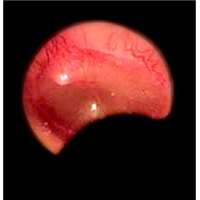 Ωτοσκόπιο Οπτικής Ίνας Heine BETA®200 με Λαμπτήρα 2.5V