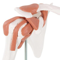 Πρόπλασμα Άρθρωσης Ώμου