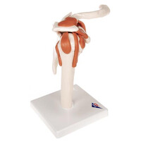 Πρόπλασμα Άρθρωσης Ώμου