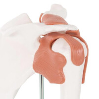 Πρόπλασμα Άρθρωσης Ώμου