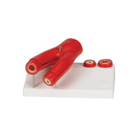 Πρόπλασμα Αρτηριοσκλήρυνσης