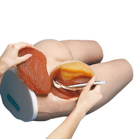 Πρόπλασμα Γλουτού για Ενδομυϊκές Εκχύσεις