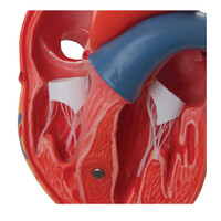 Πρόπλασμα Καρδιάς 2 Τμημάτων