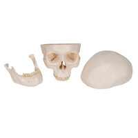 Πρόπλασμα Κρανίου 3 Τμημάτων