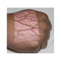 Συσκευή Ανίχνευσης Φλεβών Υπερύθρων VV-100 ENMIND