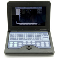 Φορητός Υπερηχογράφος CONTEC 600P2 | Convex Probe 3.5MHz