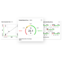 seca mBCA Pro: Αναλυτής Σύστασης Σώματος Ιατρικής Ακρίβειας