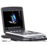 Έγχρωμος Φορητός Υπέρηχος Chison Sonobook 8