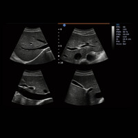 Έγχρωμος Φορητός Υπέρηχος Chison Ebit30