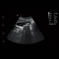 Έγχρωμος Φορητός Υπέρηχος Chison Sonobook 6