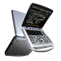 Έγχρωμος Φορητός Υπέρηχος Chison Sonobook 6