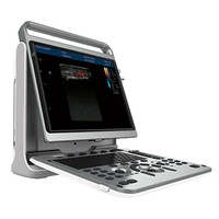 Έγχρωμος Φορητός Υπέρηχος Chison Ebit30