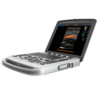 Έγχρωμος Φορητός Υπέρηχος Chison Sonobook 6