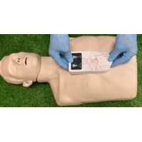 Βοήθημα Καρδιοαναπνευστικής Ανάνηψης Chest-ER