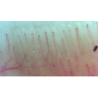 Τριχοειδοσκόπιο Inspectis CAP-1, με Λογισμικό CAP Basics Capillaroscopy