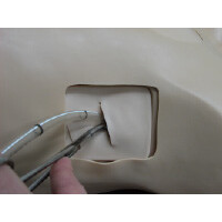 Πρόπλασμα Θωρακικών Επεμβάσεων KOKEN