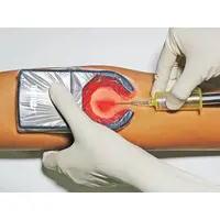 Συσκευή Ανίχνευσης Φλεβών Veinspy™