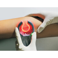 Συσκευή Ανίχνευσης Φλεβών Veinspy™