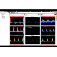 Dopplex® Vascular Reporter Software Λογισμικό Αγγειολογικών Doppler Huntleigh