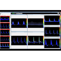 Dopplex® Vascular Reporter Software Λογισμικό Αγγειολογικών Doppler Huntleigh