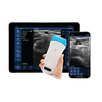 Ασύρματος Διαγνωστικός Υπέρηχος Sonostar 7.5–10MHz Linear 128 Elements BW