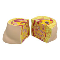 Πρόπλασμα Παχυσαρκίας Ισχίων