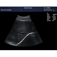 Φορητός Υπέρηχος CONTEC CMS600P2 Plus | Convex Probe 3.5MHz ή Linear Probe 7.5MHz