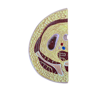 Πρόπλασμα Παχυσαρκίας Ισχίων