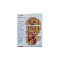 Πρόπλασμα Παχυσαρκίας Ισχίων