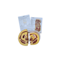 Πρόπλασμα Παχυσαρκίας Ισχίων