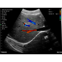 Ασύρματος Διαγνωστικός Υπέρηχος Sonostar 3.5-5.0MHz Convex Probe Color Doppler