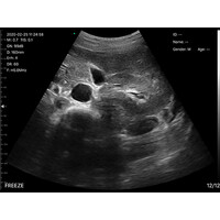 Ασύρματος Διαγνωστικός Υπέρηχος Sonostar 3.5-5.0MHz Convex Probe Color Doppler