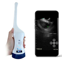 Ασύρματος Ενδοκολπικός 6.5/8.0MHz & Convex 3.5/5.0MHz Υπέρηχος Sonostar