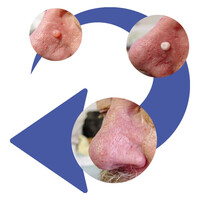 Φορητό Στυλό Κρυοπηξίας Cryopen X+ (Νέο Μοντέλο)