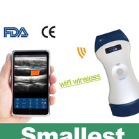 Ασύρματος Διαγνωστικός Υπέρηχος Convex 3.5/5.0MHz & Linear 7.5/10.0MHz Sonostar Blue